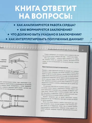 Эхокардиография для начинающих. Суть гемодинамических нарушений, позиции для анализа, определение тяжести порока