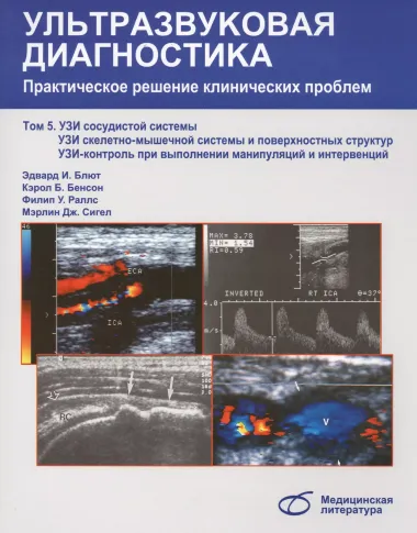 Ультразвуковая диагностика. Практическое решение клинических проблем, т. 5. УЗИ сосудистой системы.