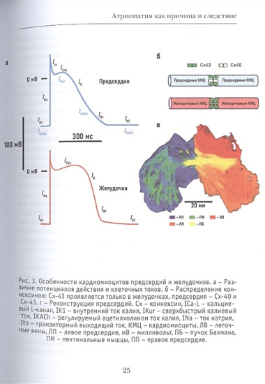 Можно ли вылечить фибрилляцию предсердий. Заметки электрофизиолога