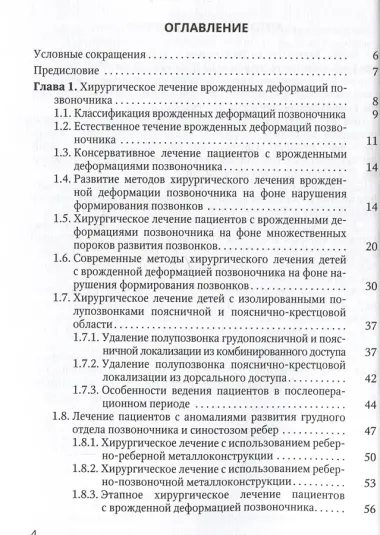 Хирургия врожденных деформаций позвоночника