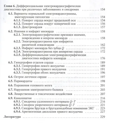 Электрокардиографическая дифференциальная диагностика