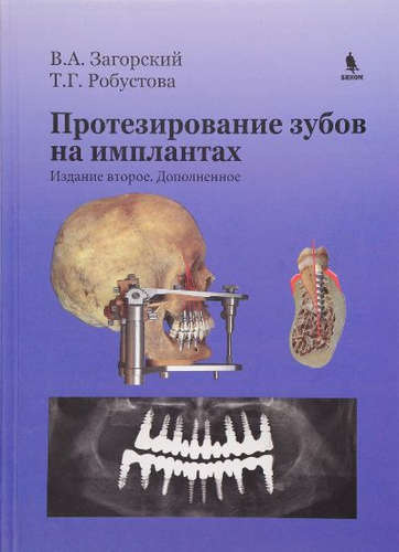 Протезирование зубов на имплантатах. Изд. 2-е, дополненное