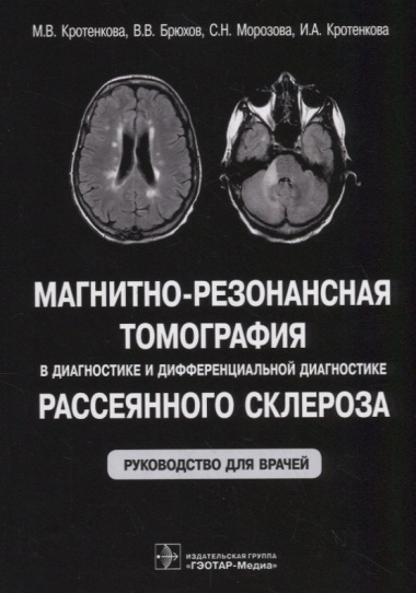 Магнитно-резонансная томография в диагностике и дифференциальной диагностике рассеянного склероза. Руководство для врачей