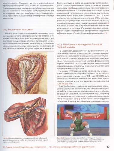 Спортивное плечо. В 3-х томах. Том 3. Эндопротезирование, травмы и реабилитация плечевого сустава