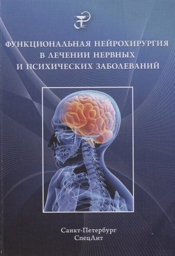 Функциональная нейрохирургия в лечении нервных и психических заболеваний