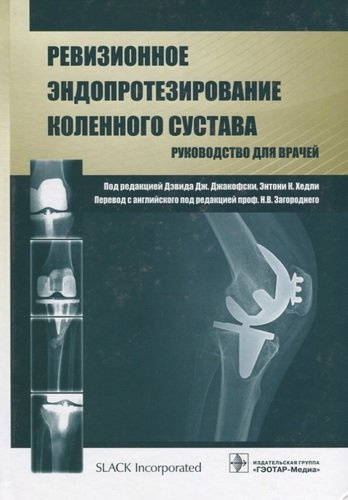 Ревизионное эндопротезирование коленного сустава : руководство для врачей