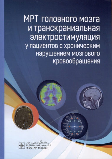 МРТ головного мозга и транскраниальная электростимуляция у пациентов с хроническим нарушением мозгового кровообращения
