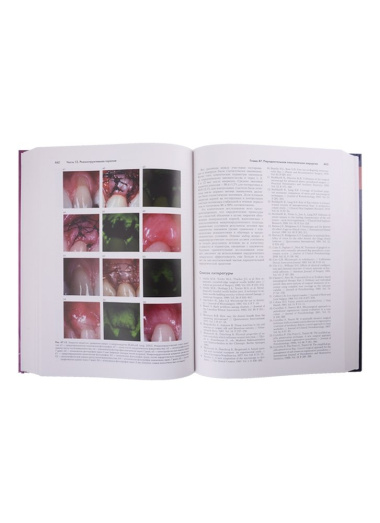 Клиническая пародонтология и дентальная имплантация . В 2-х томах. Том 2